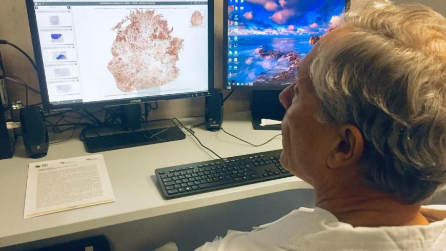 La Digital Pathology arriva a Vercelli