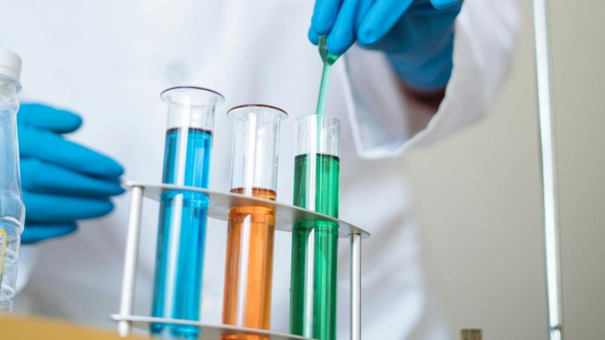 From Transcription to Traslational Control